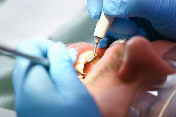 Best Emergency Dental Care for Sports Injuries in Camden, OH
