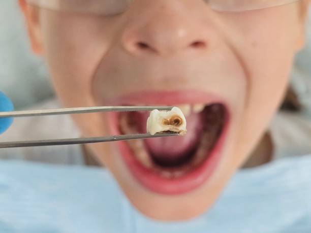 Best Emergency Denture Repair in Camden, OH