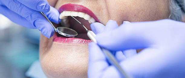 Best Emergency Root Canal Therapy in Camden, OH